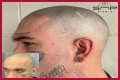 Unveiling The Truth: Steve Austin's Baldness Decoded